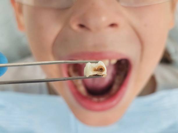 Best Pediatric Emergency Dentist in Quakertown, PA